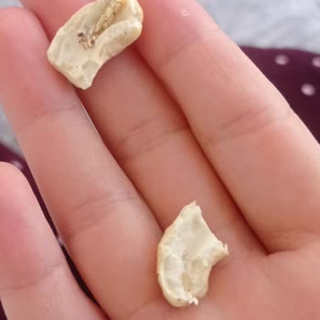 Turuncu Kuruyemiş Aldığım Lüks Çerezlerde Böcek Ve Solucan Çıkması