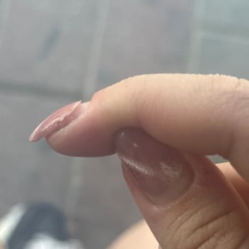 Merve Baltacı Nail Studio Steril Olmayan Malzemeler Ve Kalitesiz Nail Art Hizmeti