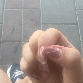 Merve Baltacı Nail Studio Steril Olmayan Malzemeler Ve Kalitesiz Nail Art Hizmeti