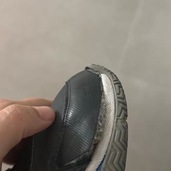 Skechers Ayakkabıda Hızlı Deformasyon Ve İade Reddi Hayal Kırıklığı Yarattı