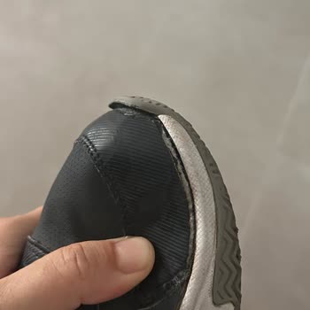 Skechers Ayakkabıda Hızlı Deformasyon Ve İade Reddi Hayal Kırıklığı Yarattı