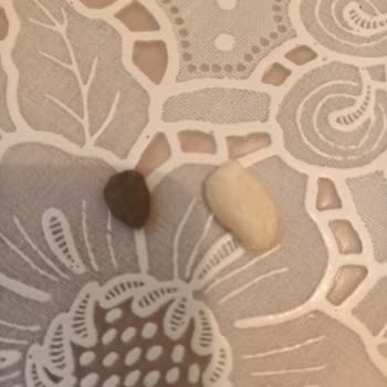 Migros Kuruyemiş İçinden Taş Çıktı, Oğlumun Dişi Zarar Gördü