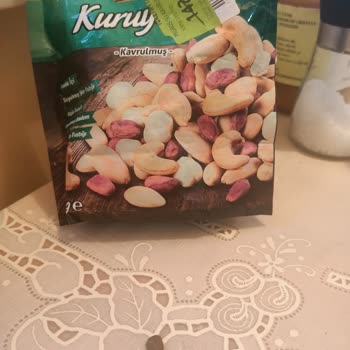 Migros Kuruyemiş İçinden Taş Çıktı, Oğlumun Dişi Zarar Gördü