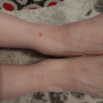 Aldığım Ayakkabıda Üretim Hatası Ve İade Talebimin Reddi