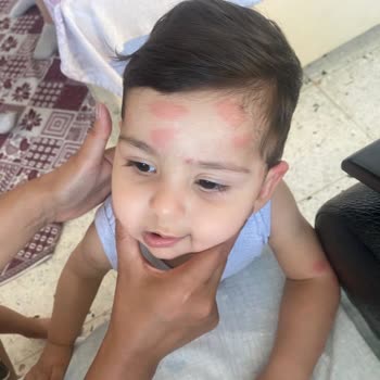 Siveno Sinek Kovucu Bebeğimi Koruyamadı