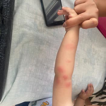 Siveno Sinek Kovucu Bebeğimi Koruyamadı