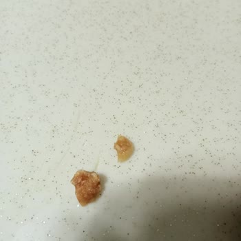 Ülker Çikolatalı Gofret İçinden Sert Cisim Çıkması Ve Hayal Kırıklığı