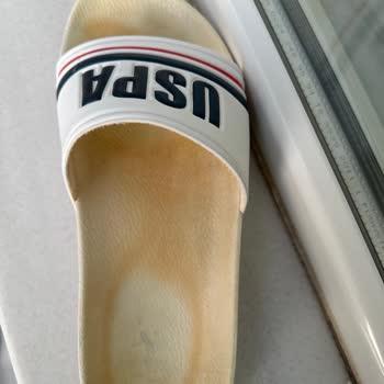 Kısa Sürede Sararan Beyaz Terliğim İçin Hayal Kırıklığı