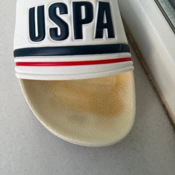 Kısa Sürede Sararan Beyaz Terliğim İçin Hayal Kırıklığı