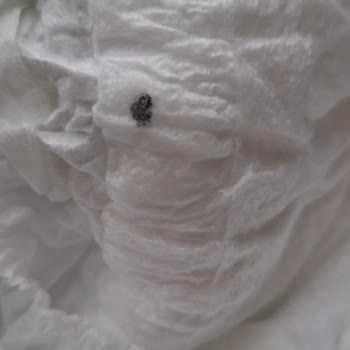 Bebek Bezinde Tekrarlayan Lekeler Güvenimi Sarstı