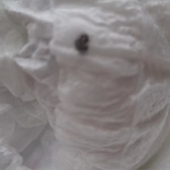 Bebek Bezinde Tekrarlayan Lekeler Güvenimi Sarstı