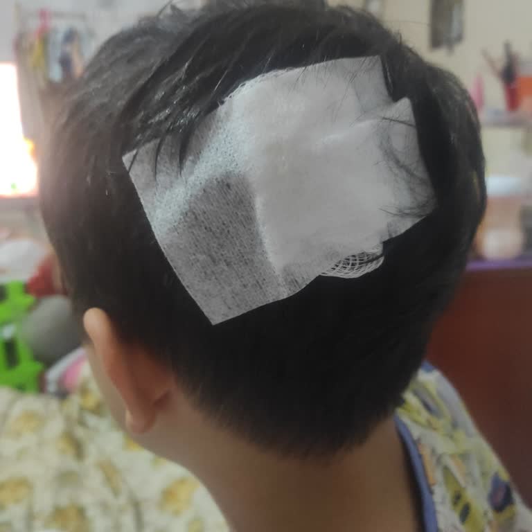 Çocuk Oyun Alanında Yetersiz Güvenlik Nedeniyle Yaşanan Kaza