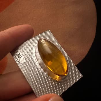 Omega Kapsülünde Büyük Parça Sorunu Endişelendiriyor