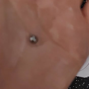 Meyveli Yoğurttan Çıkan Yabancı Cisim Çocuk Sağlığını Tehdit Etti