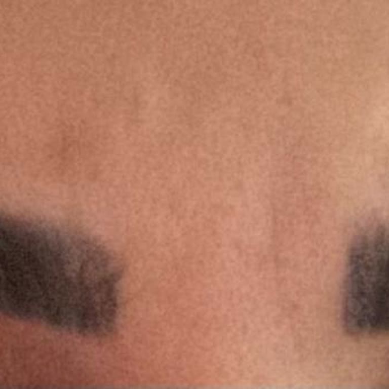 Yeniden Yaptırdığım İşlemde Hayal Kırıklığı Ve Memnuniyetsizlik