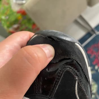 Skechers Ayakkabı 9 Ayda Yırtıldı, Kalite Hayal Kırıklığı Yaşattı