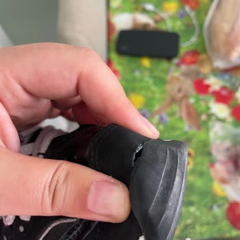 Skechers Ayakkabı 9 Ayda Yırtıldı, Kalite Hayal Kırıklığı Yaşattı