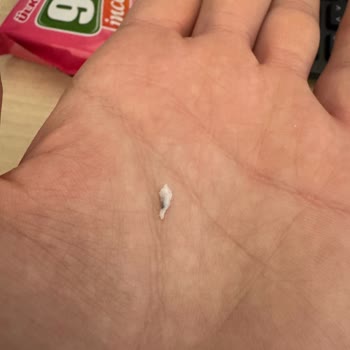 Gofretin İçinden Sert Plastik Çıktı Sağlık Riski Yaşadım