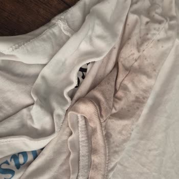 Arçelik Çamaşır Makinesi Çamaşırları Mahvediyor, Servis Çözüm Sunmuyor