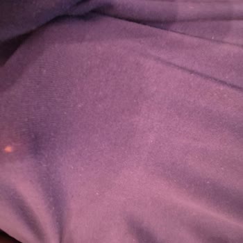 Arçelik Çamaşır Makinesi Çamaşırları Mahvediyor, Servis Çözüm Sunmuyor