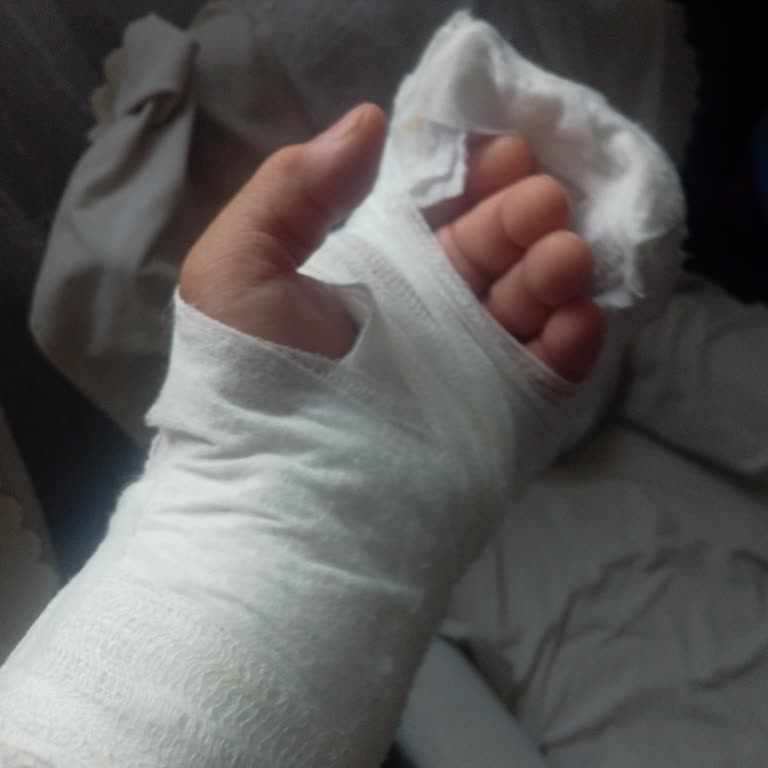 Düştükten Sonra Elimi Kaybettim Röntgenim Silindi Kimse İlgilenmiyor