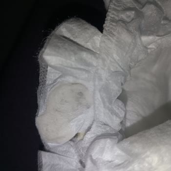 Molfix Bebek Bezi İçinde Yabancı Cisimle Karşılaştım, Endişeliyim