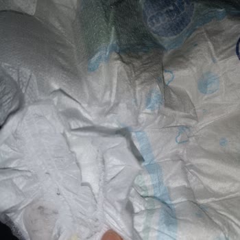 Molfix Bebek Bezi İçinde Yabancı Cisimle Karşılaştım, Endişeliyim