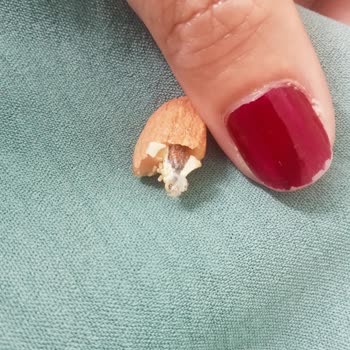 Kuruyemişte Karşılaşılan Hijyen Sorunu Ve Yaşanan Rahatsızlık