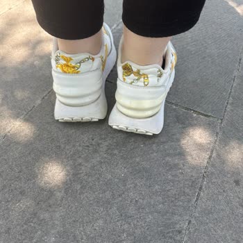 Versace Ayakkabıda Sararma Ve Boyner'in İlgisizliği