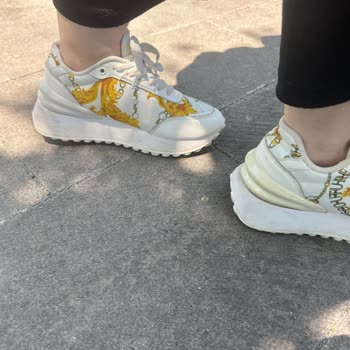 Versace Ayakkabıda Sararma Ve Boyner'in İlgisizliği