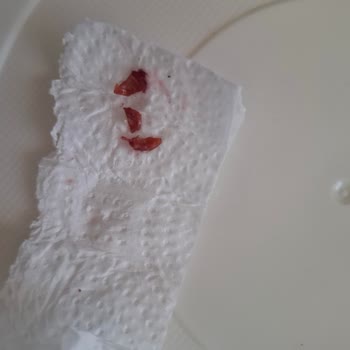 Tamek Vişne Reçelinde Tekrar Çekirdek Çıkması Dişime Zarar Verdi