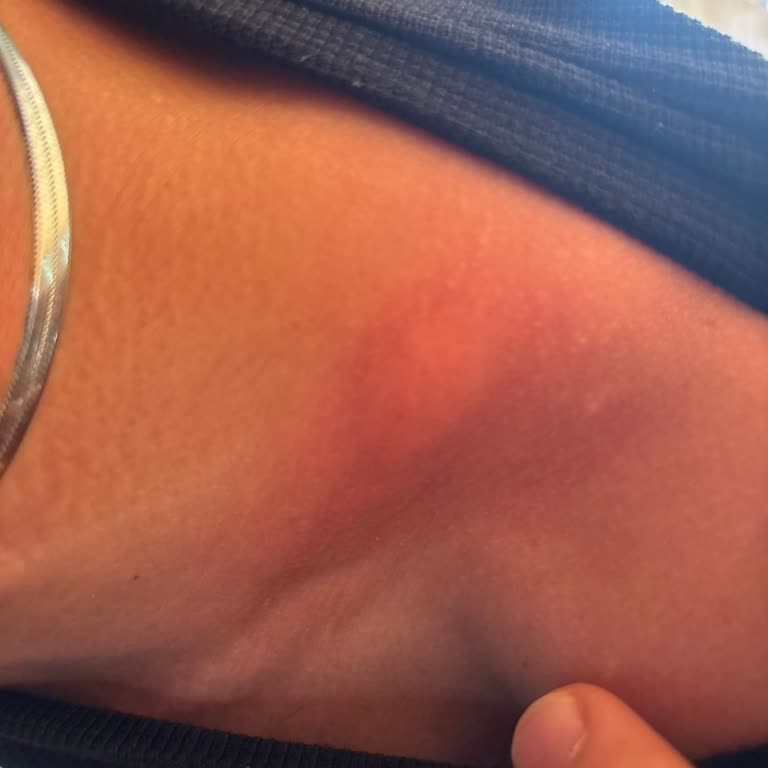 Belediyenin Yetersiz İlaçlama Ve Otopark Sorunları Mağduriyet Yaratıyor