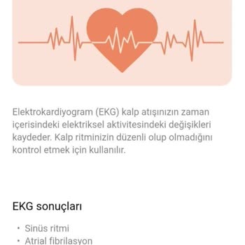 Oppo Watch Free EKG Ve Sağlık Taraması Özellikleri Çalışmıyor