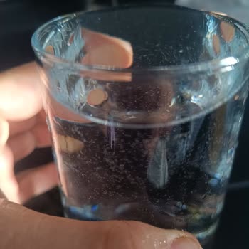 Su Arıtma Cihazı Sorunları Ve İlgisizlik Mağduriyetimi Artırıyor