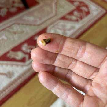 Migros'tan Alınan Ayçekirdeğinin Bayat Ve Acı Çıkması