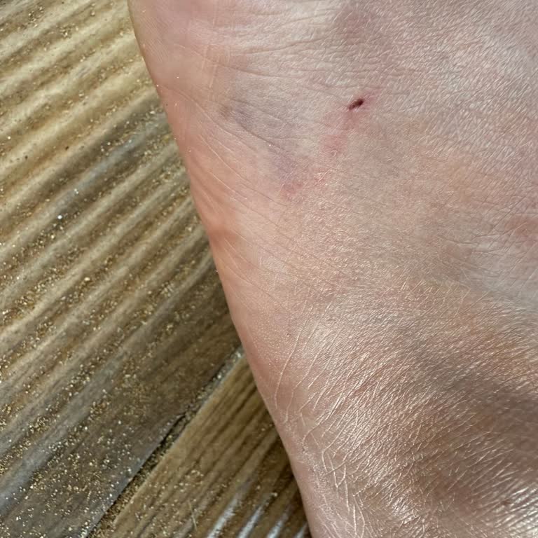 Tatilbudur Otelin Sahilinde Balon Balığı Tehlikesi Ve Yetersiz Destek