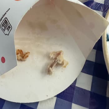 Tavuk Burgerde Kemik Çıkması Sonucu Dişimin Kırılması