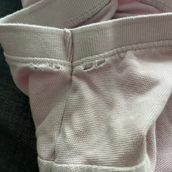 Kısa Sürede Deforme Olan Ürün İçin Çözüm Sunulmaması Hayal Kırıklığı Yarattı