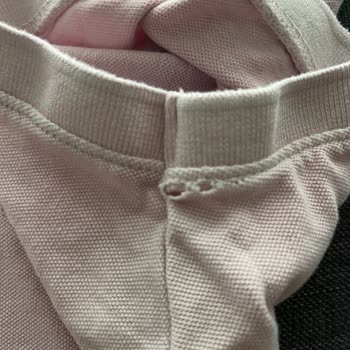 Kısa Sürede Deforme Olan Ürün İçin Çözüm Sunulmaması Hayal Kırıklığı Yarattı