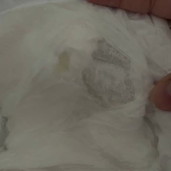 Sleepy Bebek Bezlerinde Kalite Sorunu Ve Pişik Problemi Yaşadım