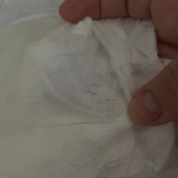 Sleepy Bebek Bezlerinde Kalite Sorunu Ve Pişik Problemi Yaşadım