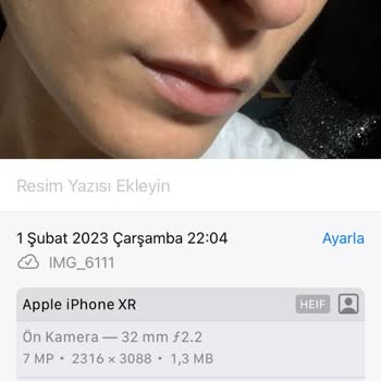 Cilt Bakımı Sonrası Yüzümde Korkunç İzler Oluştu