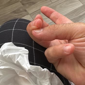 Kumtel Mutfak Robotunda Bıçak Sorunu Ve Dikkate Alınmayan Şikayetler