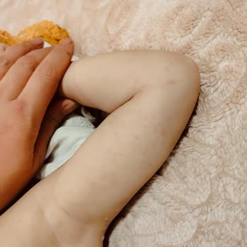 Bilim İlaç Yan Etki Gösteren İlaç Nedeniyle Yaşanan Mağduriyet Ve Sorumluluk Endişesi