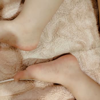 Bilim İlaç Yan Etki Gösteren İlaç Nedeniyle Yaşanan Mağduriyet Ve Sorumluluk Endişesi