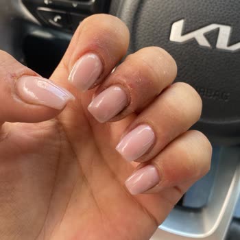 Protez Tırnak Uygulaması Sonrası Sağlık Sorunları Yaşadım