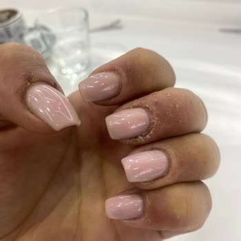 Protez Tırnak Uygulaması Sonrası Sağlık Sorunları Yaşadım