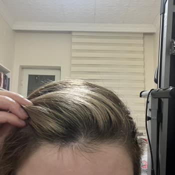 Konya MK Büyükdemir Hair Design Mağduriyet Yaşama