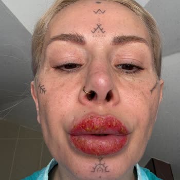 Medicana Sağlık Grubu Doktorun Davranışı ve Bilgilendirme Eksikliği Nedeniyle Yaşadığım Mağduriyet