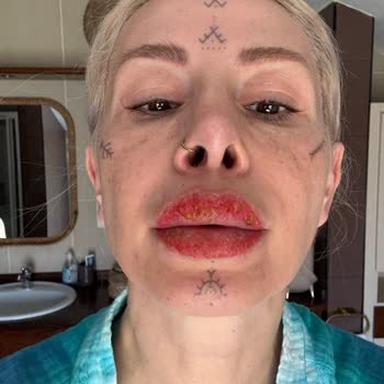 Medicana Sağlık Grubu Doktorun Davranışı ve Bilgilendirme Eksikliği Nedeniyle Yaşadığım Mağduriyet